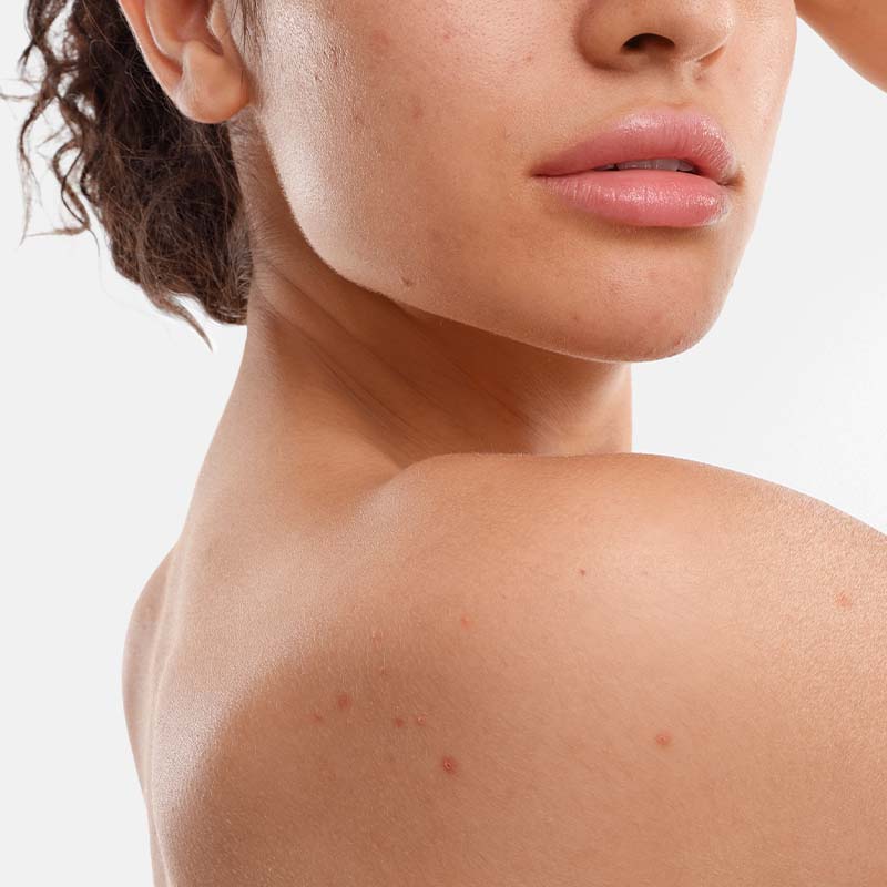 Sébium Kerato+ BIODERMA