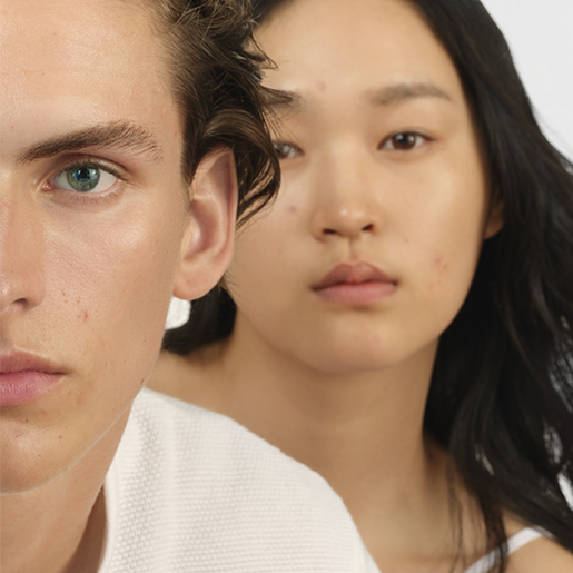 Jóvenes con piel acneica mostrando imperfecciones 