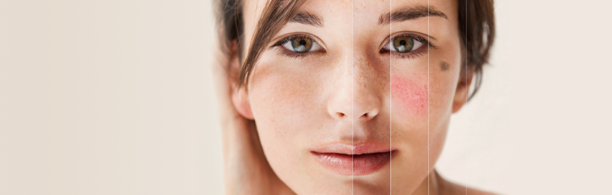 Skin Observer, analiza y descubre tu piel